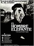 El hombre elefante