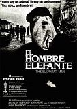 Foto: El hombre elefante