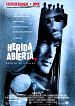 Herida abierta