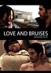Love and Bruises