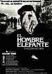 El hombre elefante
